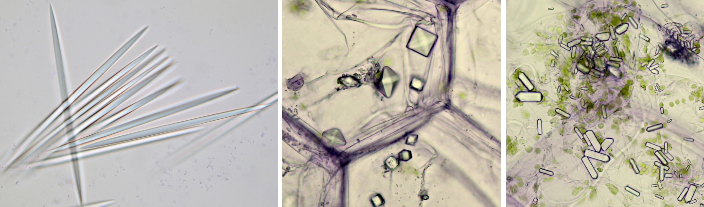 Crystals in plants | Microscopy of Nature