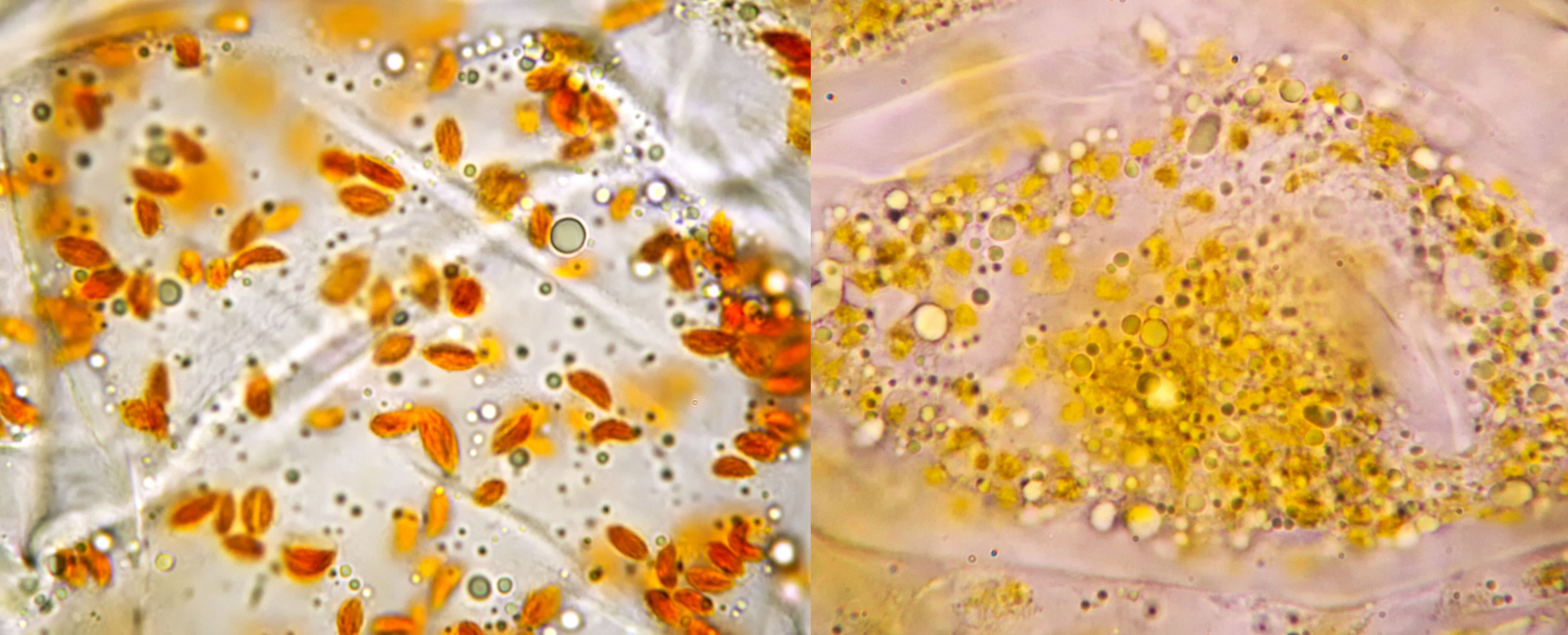Chromoplasts Microscopy of Nature