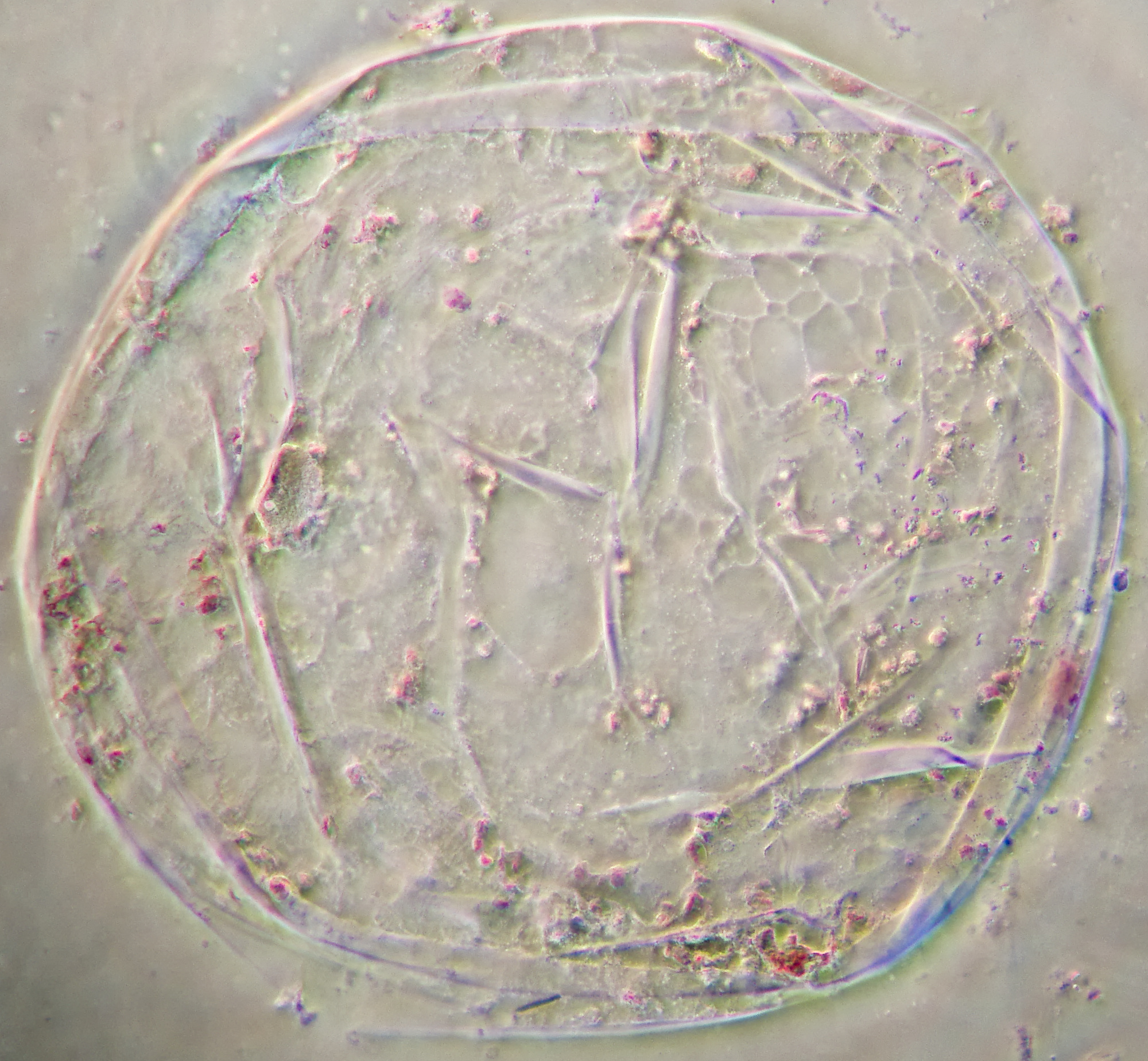 Chromoplasts Microscopy of Nature