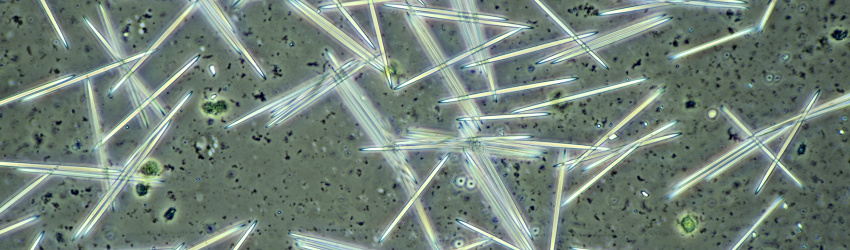 calcium oxalate crystals in plants