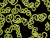 Anabaena - a cyanobacterium
