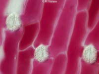Cells and stomata in a red Tulip