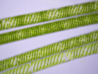 Spirogyra - a filamentous alga